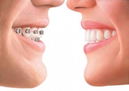 Les types de traitements orthodontiques